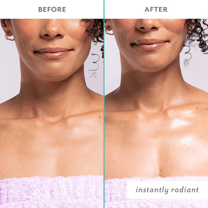 Patchology | Firm Believer Neck & Décolleté Treatment | 2-Piece Set