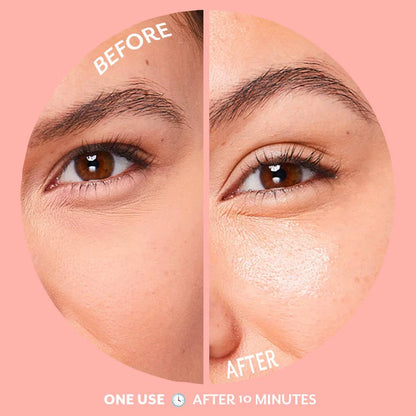 Patchology | Serve Chilled Bubbly Eye Gels | All Pack Sizes