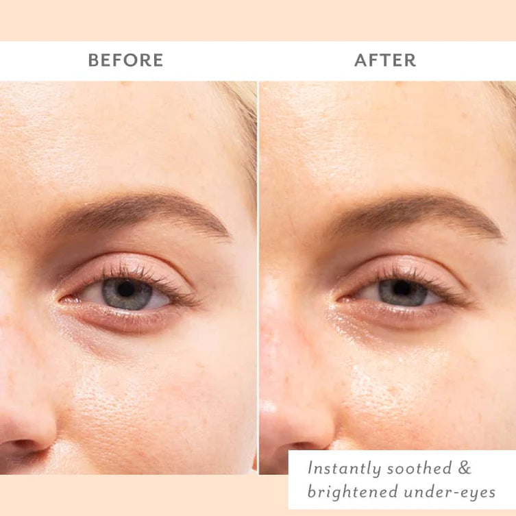 Patchology | Skin Remedy Soothing Eye Gels | All Pack Sizes
